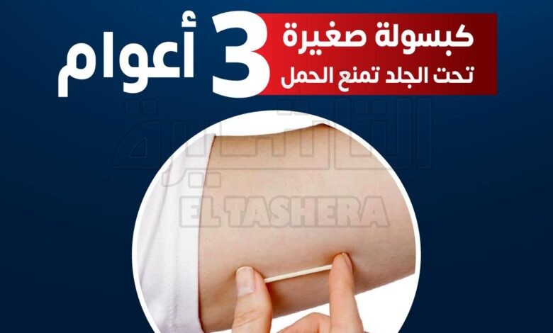 الدكتور عمرو حسن : كبسولة تحت الجلد تمنع الحمل ثلاثة أعوام